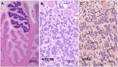 Fentanyl Induces Cerebellar Internal Granular Cell Layer Apoptosis in Healthy Newborn Pigs